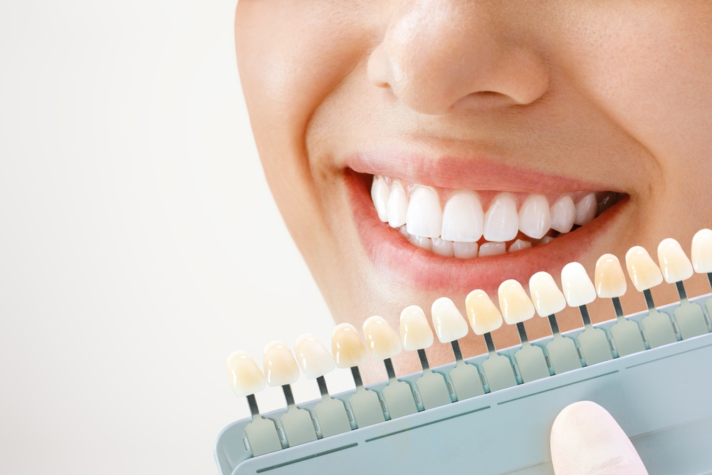Teeth Whitening Grand Prairie Tx Grand Prairie Family Dentistry