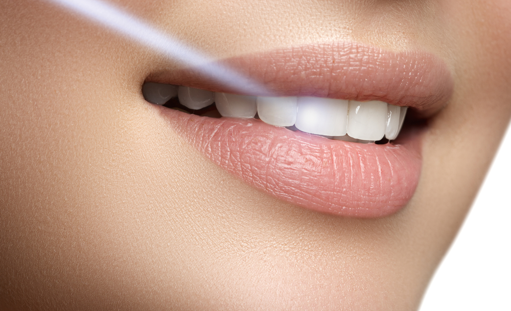 Laser Teeth Whitening Grand Prairie TX