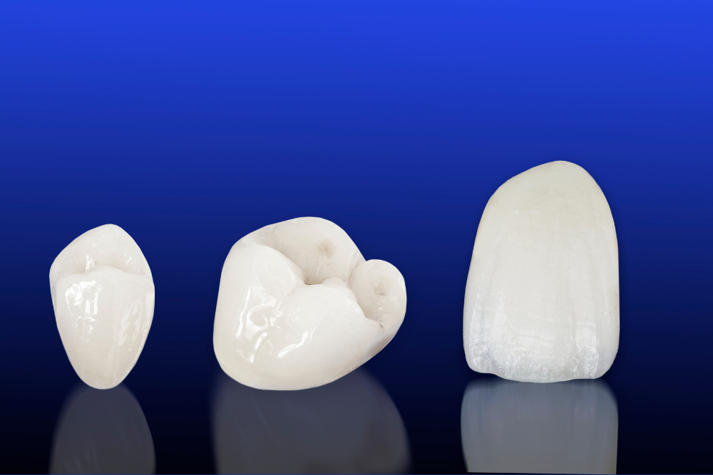Dental Implants vs Crowns