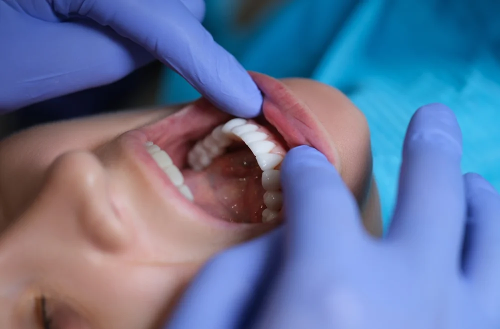 The Benefit of Laser Teeth Whitening in Grand Prairie