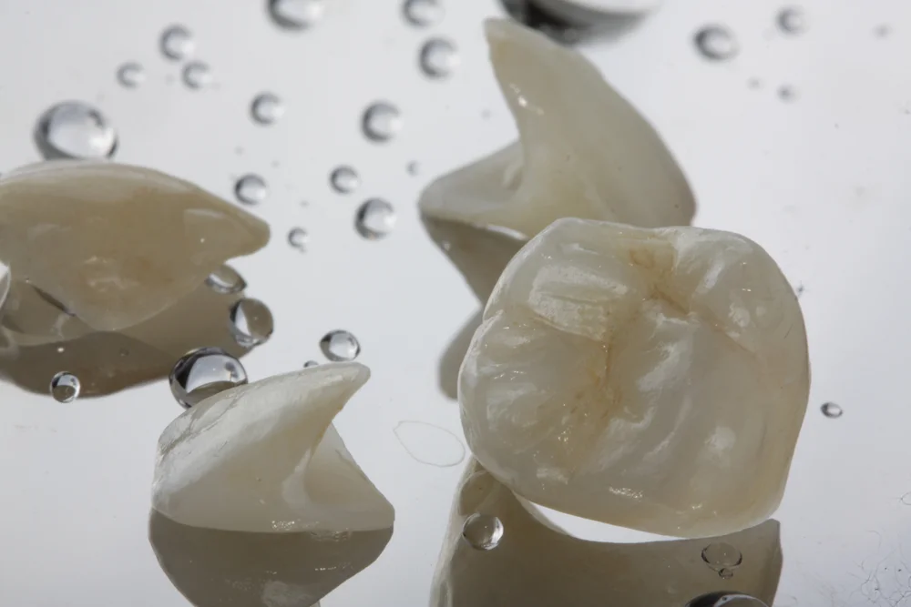 Types of Dental Crowns: Pros and Cons