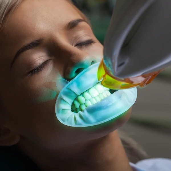 The Science Behind Teeth Bleach in Grand Prairie TX