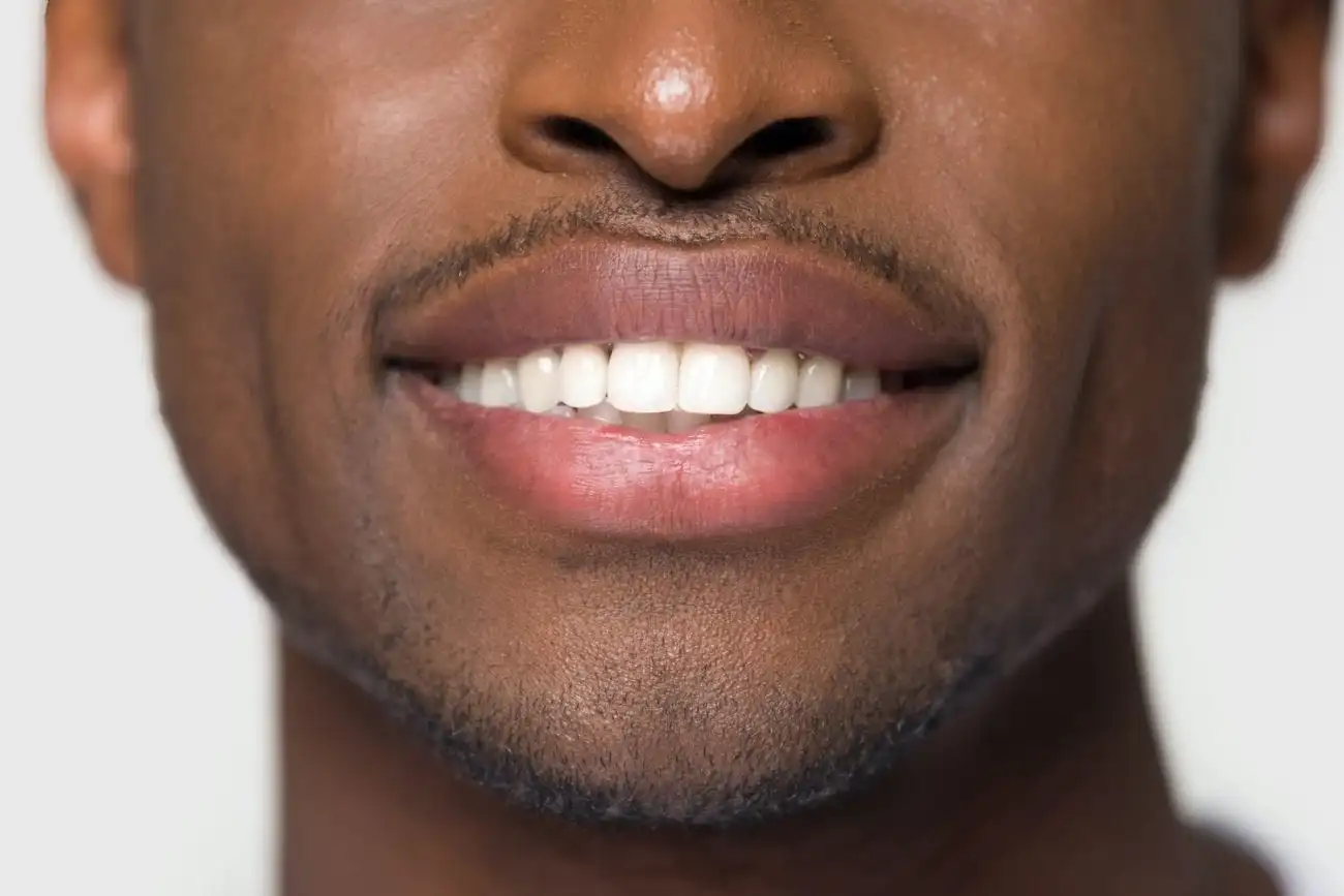 Dental Impressions: The First Step to a Perfect Crown Fit
