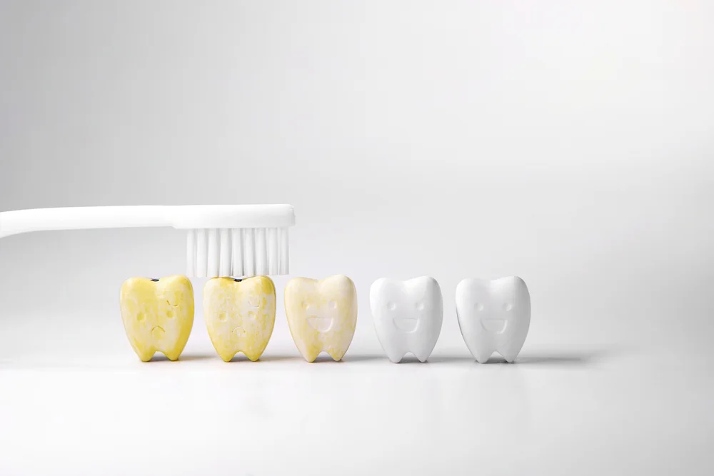 The Benefits of In-Office Teeth Whitening Bleaching